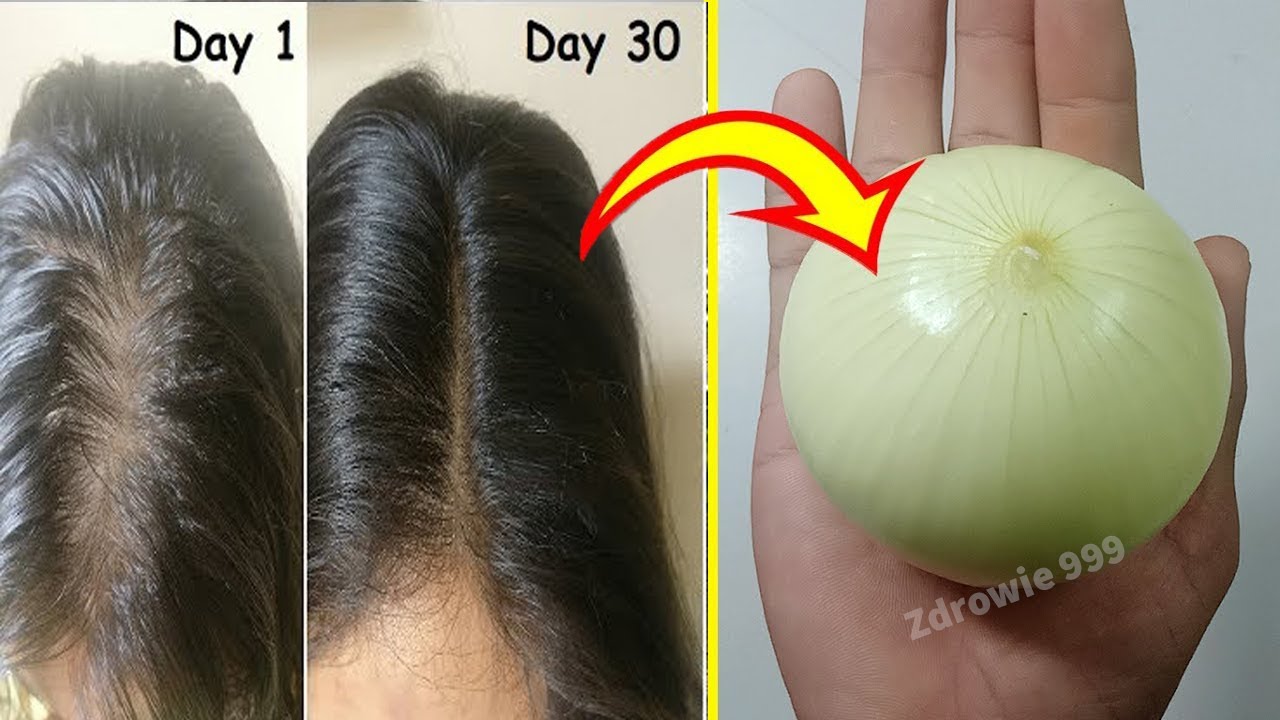 odżywka z cebuli do włosów